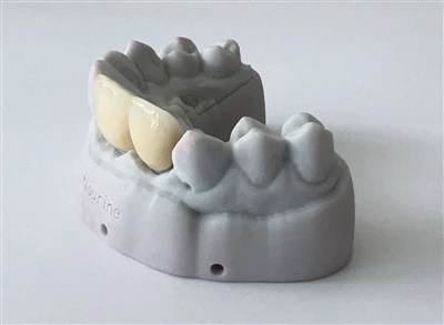 Kína 3D Print Dental Pfm Cocr Crown
